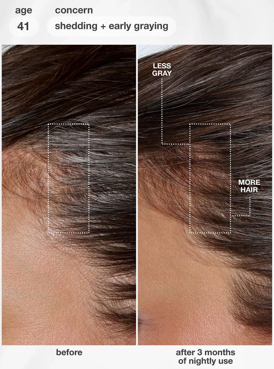 K18 - FutureIQ™ Biomimetic Hair Longevity Serum