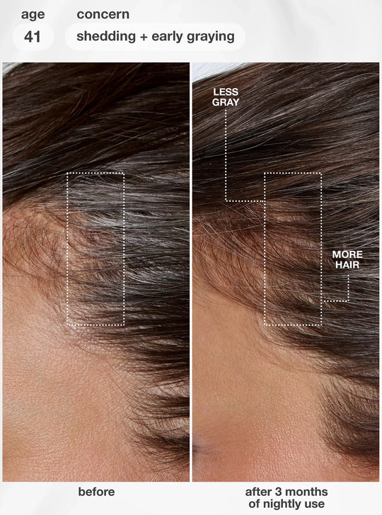 K18 - FutureIQ™ Biomimetic Hair Longevity Serum